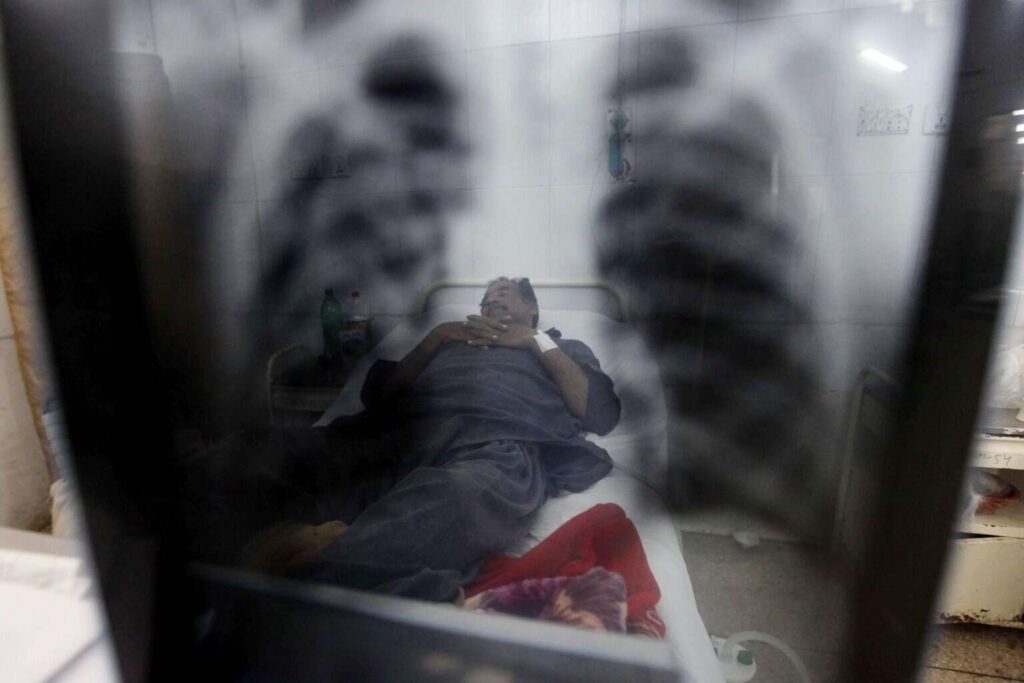 Dos casos de tuberculosis en el mayor centro de detención para migrantes de EE.UU.
