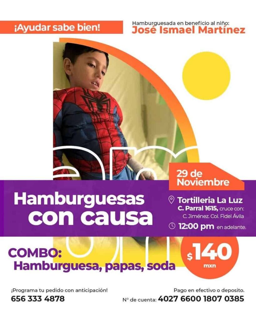 Realizan hamburguesada para ayudar a José Ismael; agentes municipales se suman